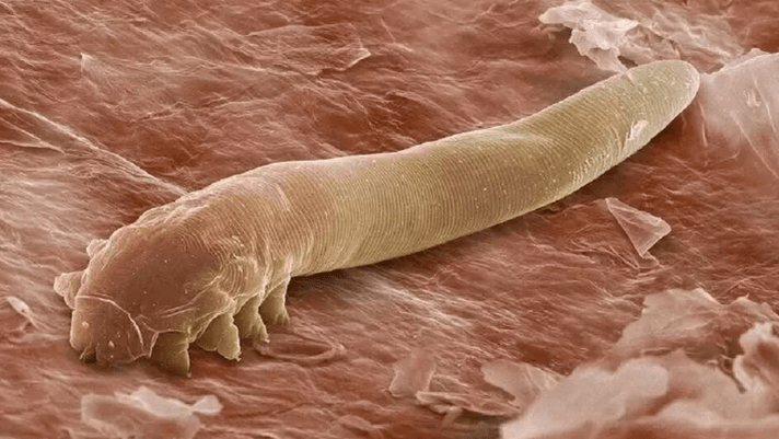 Parasites dans le corps humain