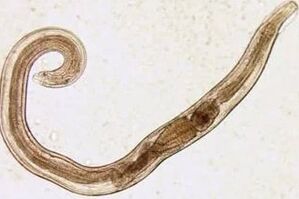 Parasites d'un homme de coupe